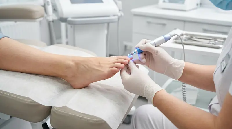 Moderne Kaltplasma-Behandlung eines Zehennagels in der podologischen Praxis
